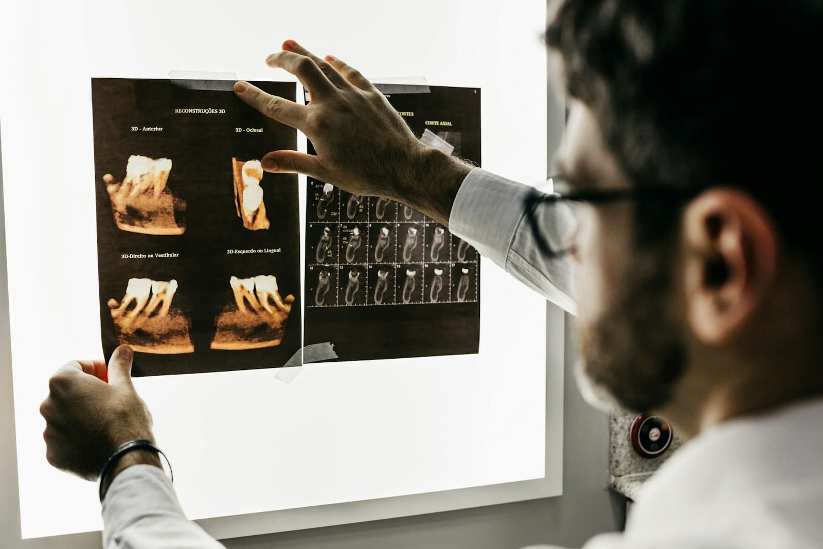 A dentist points to detail on a panoramic dental X-ray mounted on a lightbox