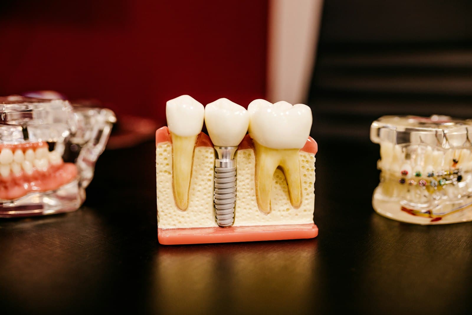 A cutaway dental model showing an implant beside natural teeth, lit against a dark red background